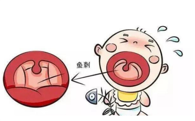 鱼刺卡喉应该选择哪个科室-小麦知识