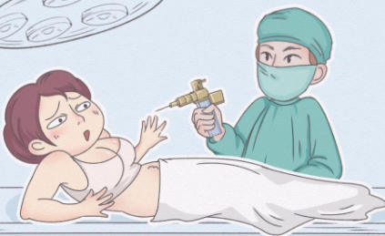 瘦腿针多少钱 瘦腿针打一支够了吗-小麦知识