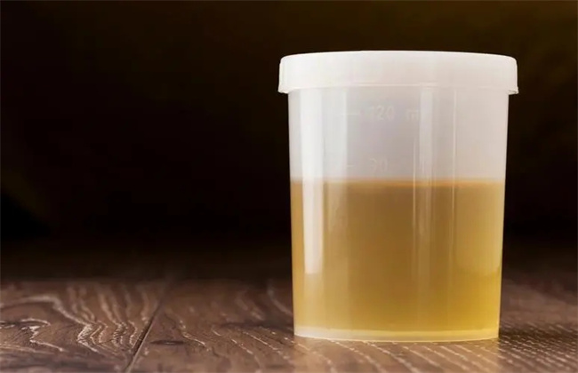 身体哪些异常多半是尿酸超标 身体出现哪些异常症状说明体内尿酸超标了-小麦知识