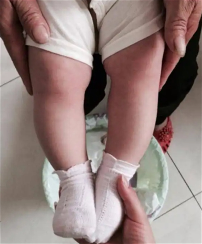 为什么不要给新生儿捆腿 新生儿需要捆腿吗-小麦知识